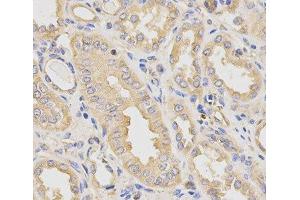 Immunohistochemistry of paraffin-embedded Human kidney using DCTN2 Polyclonal Antibody at dilution of 1:200 (40x lens).