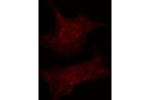 ABIN6275519 staining  Hela cells by IF/ICC.
