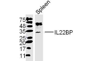 Mouse spleen lysates probed with IL22BP Polyclonal Antibody, unconjugated  at 1:300 overnight at 4°C followed by a conjugated secondary antibody at 1:10000 for 90 minutes at 37°C. (IL22RA2 anticorps  (AA 165-263))