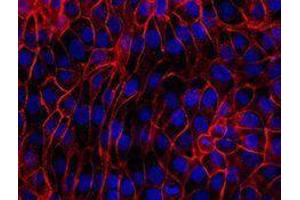 Immunofluorescence (IF) image for anti-Cadherin 1, Type 1, E-Cadherin (Epithelial) (CDH1) antibody (Alexa Fluor 647) (ABIN2657175)