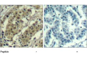 Image no. 1 for anti-V-Akt Murine Thymoma Viral Oncogene Homolog 1 (AKT1) (Thr450) antibody (ABIN319375)