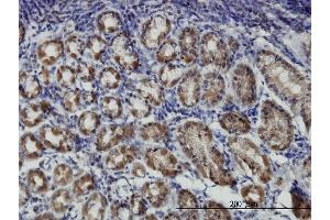 Immunoperoxidase of monoclonal antibody to PRKAR1B on formalin-fixed paraffin-embedded human stomach. (PRKAR1B anticorps  (AA 1-90))