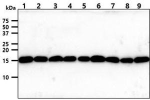 The cell lysates (40ug) were resolved by SDS-PAGE, transferred to PVDF membrane and probed with anti-human Tomm20 antibody (1:1000). (TOMM20 anticorps)