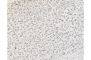 IHC analysis of JUNB using anti-JUNB antibody (ABIN7603223). (JunB anticorps  (N-Term))