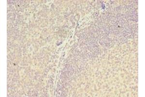Immunohistochemistry of paraffin-embedded human tonsil tissue using ABIN7175970 at dilution of 1:100 (ZNF238 anticorps  (AA 62-364))
