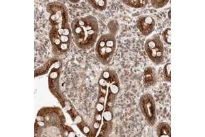 Immunohistochemical staining of human duodenum with GCN1L1 polyclonal antibody  strong cytoplasmic positivity in glandular cells at 1:50-1:200 dilution. (GCN1L1 anticorps)
