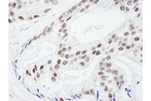 Immunohistochemistry (IHC) image for anti-RAN Binding Protein 3 (RANBP3) (AA 150-200) antibody (ABIN7449009)