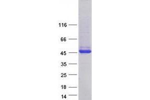 Validation with Western Blot