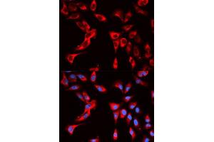 Immunofluorescence analysis of U2OS cells using EIF4B antibody. (EIF4B anticorps  (AA 352-611))