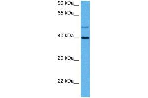Host:  Rat  Target Name:  GJA8  Sample Tissue:  Rat Skeletal Muscle  Antibody Dilution:  1ug/ml (GJA8 anticorps  (N-Term))