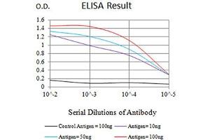 Black line: Control Antigen (100 ng),Purple line: Antigen (10 ng), Blue line: Antigen (50 ng), Red line:Antigen (100 ng) (IDH2 anticorps  (AA 1-143))