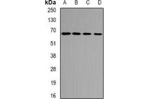 Western blot analysis of ETFDH expression in mouse heart (A), mouse kidney (B), rat liver (C), rat heart (D) whole cell lysates.