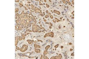 IHC analysis of TST using anti-TST antibody (ABIN7599105). (TST anticorps  (AA 1-220))