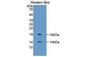 Western blot analysis of the recombinant protein. (FABP4 anticorps  (AA 1-125))
