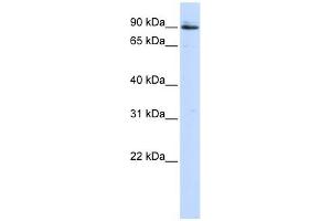 PCSK5 antibody used at 1 ug/ml to detect target protein. (PCSK5 anticorps  (Middle Region))