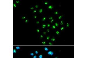 Immunofluorescence analysis of MCF-7 cells using EIF6 Polyclonal Antibody (EIF6 anticorps)