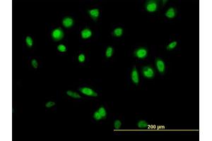Immunofluorescence of  purified  MaxPab antibody to GPS1 on HeLa cell. (GPS1 anticorps  (AA 1-527))