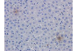 Immunohistochemical analysis of rat liver using anti-TNFalpha antibody   Formalin fixed rat liver slices were stained with a  at 5 µg/ml. (Recombinant TNF alpha (Humicade Biosimilar) anticorps)