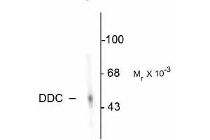 Western blots of rat adrenal medulla. (DDC anticorps)