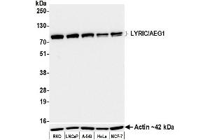 Western Blotting (WB) image for anti-Metadherin (MTDH) (AA 475-525) antibody (ABIN7795651)