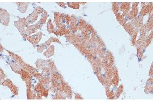 Immunohistochemistry of paraffin-embedded Rat heart using ACSL3 Polyclonal Antibody at dilution of 1:100 (40x lens).