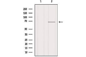 Western blot analysis of extracts from Mouse lung, using Ezrin Antibody.
