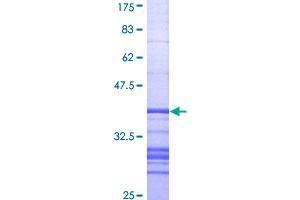 Image no. 1 for Alkaline Phosphatase, Liver/bone/kidney (ALPL) (AA 91-200) protein (GST tag) (ABIN1344939)