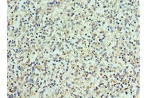 Immunohistochemistry of paraffin-embedded human spleen tissue using ABIN7145171 at dilution of 1:100 (BCL11A anticorps  (AA 1-230))