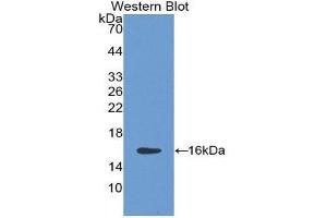 Western Blotting (WB) image for anti-HtrA Serine Peptidase 1 (HTRA1) (AA 10-146) antibody (ABIN1859231) (HTRA1 anticorps  (AA 10-146))