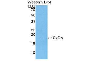 Western Blotting (WB) image for anti-Sucrase-Isomaltase (Alpha-Glucosidase) (SI) (AA 1717-1827) antibody (ABIN1176025) (Sucrase Isomaltase anticorps  (AA 1717-1827))