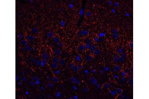 Indirect immunofluorescence labeling of PFA fixed, paraffin embedded mouse brain section (dilution 1 : 500; red).