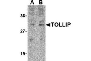 Western Blotting (WB) image for anti-Toll Interacting Protein (TOLLIP) (C-Term) antibody (ABIN1030762) (TOLLIP anticorps  (C-Term))