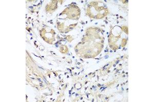Immunohistochemistry of paraffin-embedded human stomach using NID1 antibody at dilution of 1:100 (40x lens). (Nidogen 1 anticorps)