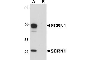 Western Blotting (WB) image for anti-Secernin 1 (SCRN1) (C-Term) antibody (ABIN1030648) (Secernin 1 anticorps  (C-Term))