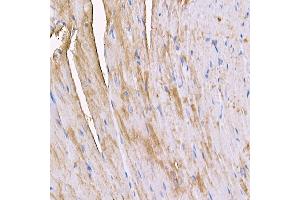 Immunohistochemistry of paraffin-embedded mouse heart using MYH4 antibody (ABIN7268749) at dilution of 1:150 (40x lens).