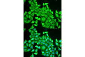 Immunofluorescence (IF) image for anti-RAB6A, Member RAS Oncogene Family (RAB6A) antibody (ABIN1876814) (RAB6A anticorps)