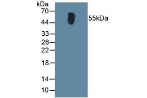 Detection of ALT in Human Serum using Polyclonal Antibody to Alanine Aminotransferase (ALT) (ALT anticorps  (AA 367-480))
