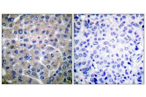 Immunohistochemistry (IHC) image for anti-Breast Cancer Anti-Estrogen Resistance 1 (BCAR1) (Tyr410) antibody (ABIN1847916)