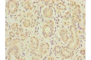 Immunohistochemistry of paraffin-embedded human salivary gland tissue using ABIN7170019 at dilution of 1:100 (SLC5A1 anticorps  (AA 239-288))