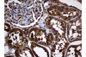 Image no. 5 for anti-SERPINE1 mRNA Binding Protein 1 (SERBP1) (AA 1-262) antibody (ABIN1490674)