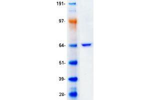 Validation with Western Blot