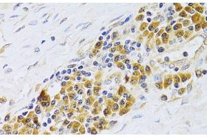 Immunohistochemistry of paraffin-embedded Human esophagus using PA2G4 Polyclonal Antibody at dilution of 1:100 (40x lens). (PA2G4 anticorps)
