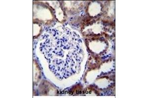 CASP3 Antibody (C-term) (ABIN655271 and ABIN2844863) immunohistochemistry analysis in formalin fixed and paraffin embedded human kidney tissue followed by peroxidase conjugation of the secondary antibody and DAB staining.