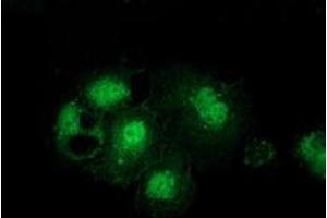 Anti-GSS mouse monoclonal antibody (ABIN2453904) immunofluorescent staining of COS7 cells transiently transfected by pCMV6-ENTRY GSS (RC203174). (Glutathione Synthetase anticorps)