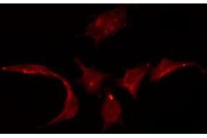 ABIN6275333 staining HuvEc by IF/ICC. (SLC22A3 anticorps  (Internal Region))