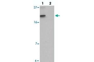 Western blot analysis of SPINK2 in mouse heart tissue with SPINK2 polyclonal antibody  at 1 ug/mL in (lane 1) the absence and (lane 2) the presence of blocking peptide.