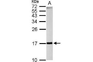 WB Image FIS1 antibody detects FIS1 protein by Western blot analysis.