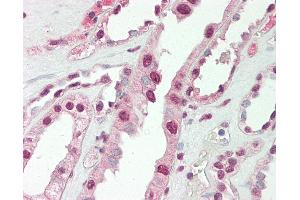 Human Kidney: Formalin-Fixed, Paraffin-Embedded (FFPE).