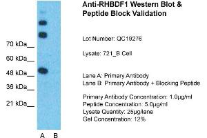 Host:  Rabbit  Target Name:  RHBDF1  Sample Type:  721_B Whole Cell  Lane A:  Primary Antibody  Lane B:  Primary Antibody + Blocking Peptide  Primary Antibody Concentration:  1ug/ml  Peptide Concentration:  5ug/ml  Lysate Quantity:  25ug/lane/Lane  Gel Concentration:  0. (RHBDF1 anticorps  (N-Term))