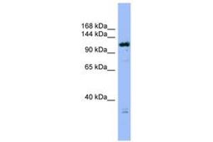 Image no. 1 for anti-HAUS Augmin-Like Complex, Subunit 6 (HAUS6) (C-Term) antibody (ABIN6742147) (FAM29A anticorps  (C-Term))